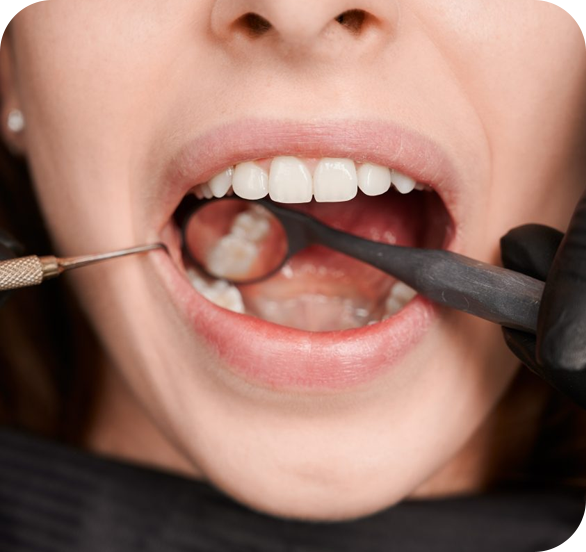 Dente do Siso