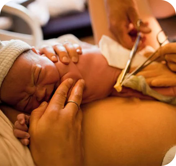 Pioneirismo Cordão umbilical